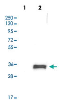 TNFSF12-TNFSF13, Rabbit, Polyclonal Antibody, Abnova 100 &mu;L | Buy Online | Abnova Corporation | Fisher Scientific