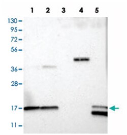RP11-544M224, Rabbit, Polyclonal Antibody, Abnova 100 &mu;L | Buy Online | Abnova Corporation | Fisher Scientific