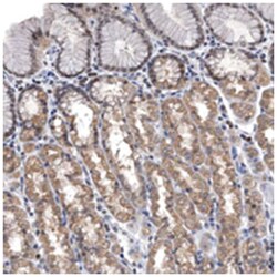 RP11-544M224, Rabbit, Polyclonal Antibody, Abnova 100 &mu;L | Buy Online | Abnova Corporation | Fisher Scientific