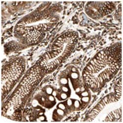 TAPBP, Rabbit, Polyclonal Antibody, Abnova 100&mu;L; Unlabeled:Antibodies,