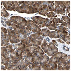 TMED7-TICAM2, Rabbit, Polyclonal Antibody, Abnova 100 &mu;L | Buy Online | Abnova Corporation | Fisher Scientific