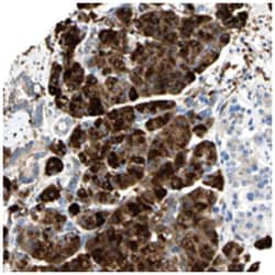 NCBP2L, Rabbit, Polyclonal Antibody, Abnova 100 &mu;L | Buy Online | Abnova Corporation | Fisher Scientific