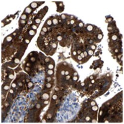 C6orf170, Rabbit, Polyclonal Antibody, Abnova 100 &mu;L | Buy Online | Abnova Corporation | Fisher Scientific