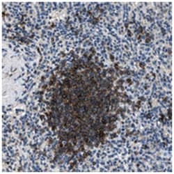 SALL3, Rabbit, Polyclonal Antibody, Abnova 100 &mu;L | Buy Online | Abnova Corporation | Fisher Scientific