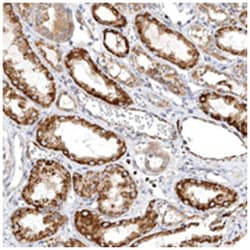 TTLL8, Rabbit, Polyclonal Antibody, Abnova 100 &mu;L | Buy Online | Abnova Corporation | Fisher Scientific