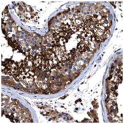 OR10S1, Rabbit, Polyclonal Antibody, Abnova 100 &mu;L | Buy Online | Abnova Corporation | Fisher Scientific