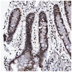 EFCAB10, Rabbit, Polyclonal Antibody, Abnova 100 &mu;L | Buy Online | Abnova Corporation | Fisher Scientific