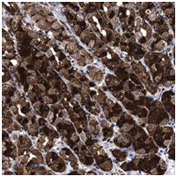 WDR86, Rabbit, Polyclonal Antibody, Abnova 100 &mu;L | Buy Online | Abnova Corporation | Fisher Scientific