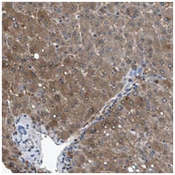 CDRT4, Rabbit, Polyclonal Antibody, Abnova 100 &mu;L | Buy Online | Abnova | Fisher Scientific