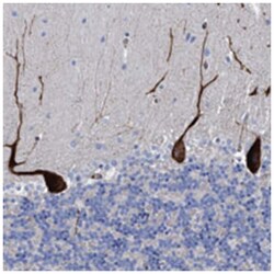 HS3ST5, Rabbit, Polyclonal Antibody, Abnova 100 &mu;L | Buy Online | Abnova Corporation | Fisher Scientific
