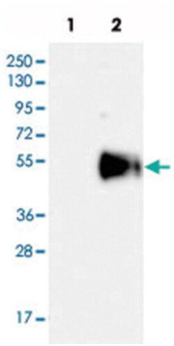 HS3ST5, Rabbit, Polyclonal Antibody, Abnova 100 &mu;L | Buy Online | Abnova Corporation | Fisher Scientific