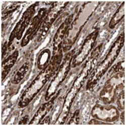 CCDC57 Rabbit anti-Human, Polyclonal Antibody, Abnova 100 &mu;L | Buy Online | Abnova Corporation | Fisher Scientific