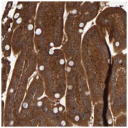 CCDC57 Rabbit anti-Human, Polyclonal Antibody, Abnova 100 &mu;L | Buy Online | Abnova Corporation | Fisher Scientific