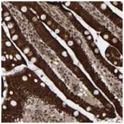 CCDC57 Rabbit anti-Human, Polyclonal Antibody, Abnova 100 &mu;L | Buy Online | Abnova Corporation | Fisher Scientific