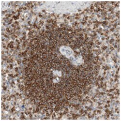 CCDC57 Rabbit anti-Human, Polyclonal Antibody, Abnova 100 &mu;L | Buy Online | Abnova | Fisher Scientific