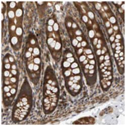 BAHCC1, Rabbit, Polyclonal Antibody, Abnova 100 &mu;L | Buy Online | Abnova Corporation | Fisher Scientific