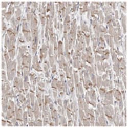 FAM82B, Rabbit, Polyclonal Antibody, Abnova 100 &mu;L | Buy Online | Abnova Corporation | Fisher Scientific
