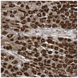 C2orf74, Rabbit, Polyclonal Antibody, Abnova 100 &mu;L | Buy Online | Abnova Corporation | Fisher Scientific