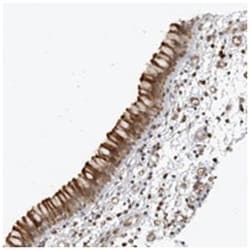 CNBD1 Rabbit anti-Human, Polyclonal Antibody, Abnova 100&mu;L; Unlabeled:Anticuerpos