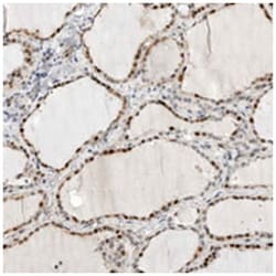 METTL11B, Rabbit, Polyclonal Antibody, Abnova 100&mu;L; Unlabeled:Antibodies,