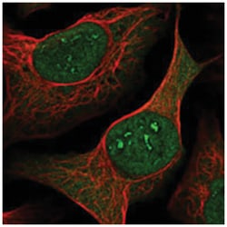 METTL11B, Rabbit, Polyclonal Antibody, Abnova 100&mu;L; Unlabeled:Antibodies,