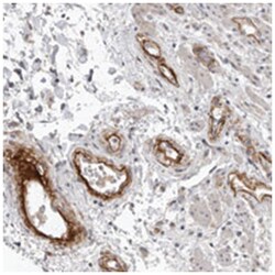 C1orf216, Rabbit, Polyclonal Antibody, Abnova 100 &mu;L | Buy Online | Abnova Corporation | Fisher Scientific