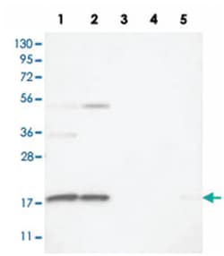 RPS25 Rabbit anti-Human, Mouse, Rat, Polyclonal Antibody, Abnova 100 &mu;L | Buy Online | Abnova Corporation | Fisher Scientific