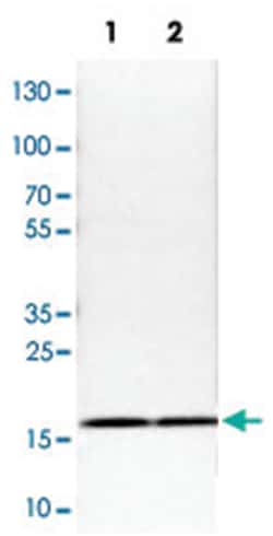 RPS25 Rabbit anti-Human, Mouse, Rat, Polyclonal Antibody, Abnova 100 &mu;L | Buy Online | Abnova Corporation | Fisher Scientific