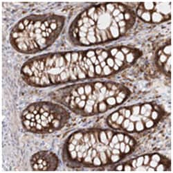 RPS25 Rabbit anti-Human, Mouse, Rat, Polyclonal Antibody, Abnova 100 &mu;L | Buy Online | Abnova Corporation | Fisher Scientific
