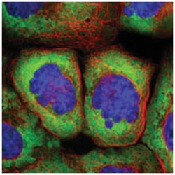 RPS25 Rabbit anti-Human, Mouse, Rat, Polyclonal Antibody, Abnova 100 &mu;L | Buy Online | Abnova Corporation | Fisher Scientific