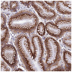 TUBGCP6 Rabbit anti-Human, Polyclonal Antibody, Abnova 100&mu;L; Unlabeled:Antibodies,