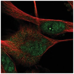 DRGX, Rabbit, Polyclonal Antibody, Abnova 100&mu;L; Unlabeled:Antibodies,