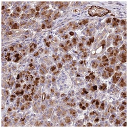 ANKRD50, Rabbit, Polyclonal Antibody, Abnova 100 &mu;L | Buy Online | Abnova Corporation | Fisher Scientific