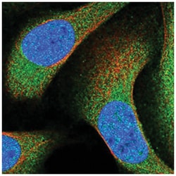 ANKRD50, Rabbit, Polyclonal Antibody, Abnova 100 &mu;L | Buy Online | Abnova Corporation | Fisher Scientific
