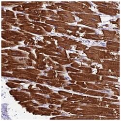 KIAA0408, Rabbit, Polyclonal Antibody, Abnova 100 &mu;L | Buy Online | Abnova Corporation | Fisher Scientific