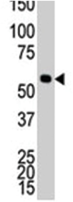 CAMK1G, Rabbit, Polyclonal Antibody, Abnova 400 &mu;L | Buy Online | Abnova Corporation | Fisher Scientific