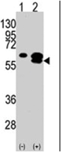 CAMK1G, Rabbit, Polyclonal Antibody, Abnova 400 &mu;L | Buy Online | Abnova Corporation | Fisher Scientific