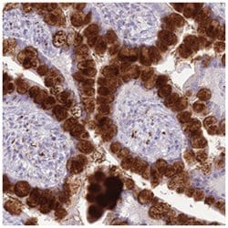 DHDH, Rabbit, Polyclonal Antibody, Abnova 100 &mu;L | Buy Online | Abnova Corporation | Fisher Scientific