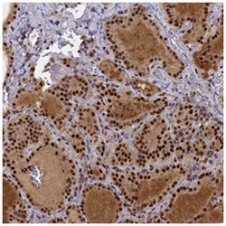 SECISBP2, Rabbit, Polyclonal Antibody, Abnova 100&mu;L; Unlabeled:Antibodies,