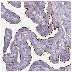 NME5, Rabbit, Polyclonal Antibody, Abnova 100 &mu;L | Buy Online | Abnova Corporation | Fisher Scientific