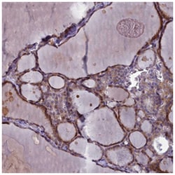 ARL15 Rabbit anti-Human, Polyclonal Antibody, Abnova 100 &mu;L | Buy Online | Abnova Corporation | Fisher Scientific
