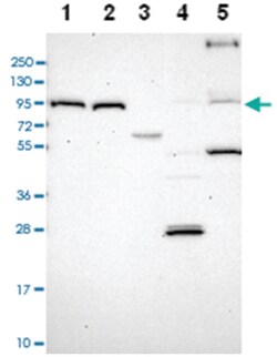 TRPV2 Rabbit anti-Human, Polyclonal Antibody, Abnova 100&mu;L; Unlabeled:Antibodies,