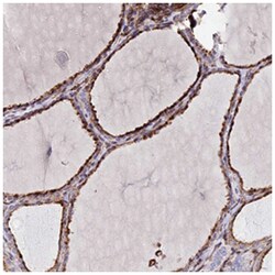 TRPV2 Rabbit anti-Human, Polyclonal Antibody, Abnova 100&mu;L; Unlabeled:Antibodies,