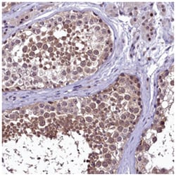 PRNT, Rabbit, Polyclonal Antibody, Abnova 100 &mu;L | Buy Online | Abnova Corporation | Fisher Scientific