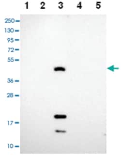 CEACAM16, Rabbit, Polyclonal Antibody, Abnova 100&mu;L; Unlabeled:Antibodies,
