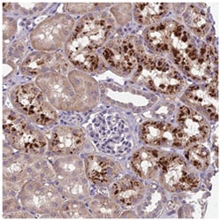 CEACAM16, Rabbit, Polyclonal Antibody, Abnova 100&mu;L; Unlabeled:Antibodies,