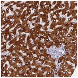 CYP2D6 Rabbit anti-Human, Polyclonal Antibody, Abnova 100&mu;L; Unlabeled:Antibodies,