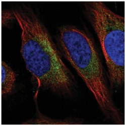C6orf47, Rabbit, Polyclonal Antibody, Abnova 100 &mu;L | Buy Online | Abnova Corporation | Fisher Scientific