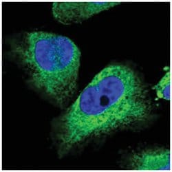 STC2 Rabbit anti-Human, Polyclonal Antibody, Abnova 100 &mu;L | Buy Online | Abnova Corporation | Fisher Scientific