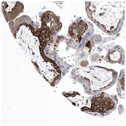 C14orf100, Rabbit, Polyclonal Antibody, Abnova 100 &mu;L | Buy Online | Abnova | Fisher Scientific